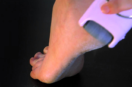 The iCare Electrical Callus Remover