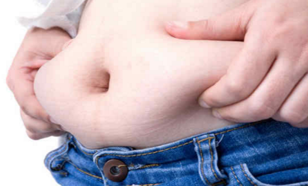 Understanding Obesity: America’s Epidemic